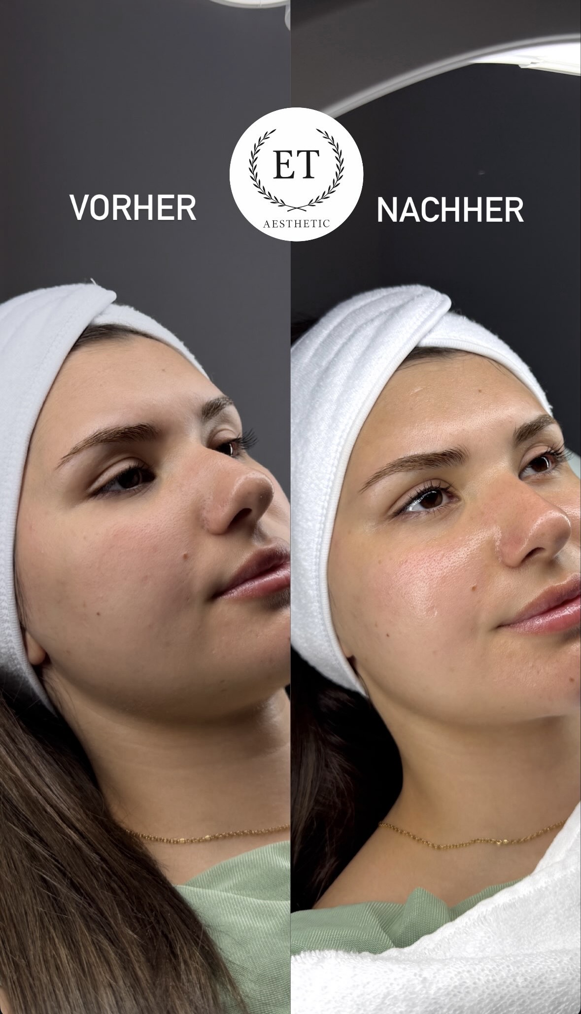 Vorher-Nachher-Vergleich einer Gesichtsbehandlung im ET Aesthetic Kosmetikstudio